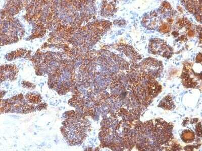 Immunohistochemistry-Paraffin: PTH Antibody (PTH/1173) - Azide and BSA Free [NBP2-47728] - Human Parathyroid stained with PTH Monoclonal Antibody (PTH/1173).