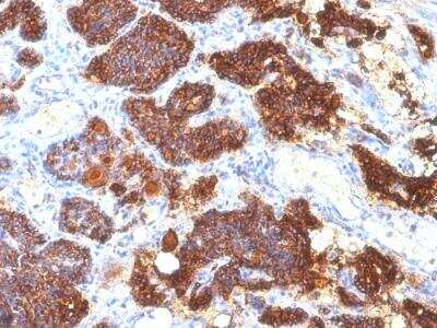 Immunohistochemistry-Paraffin: PTH Antibody (PTH/1175) - IHC-Prediluted [NBP2-48403] - Formalin-fixed, paraffin-embedded human Parathyroid Gland stained with PTH Mouse Monoclonal Antibody (PTH/1175).