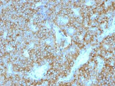 Immunohistochemistry-Paraffin: PTH Antibody (PTH/1175) - IHC-Prediluted [NBP2-48403] - Formalin-fixed, paraffin-embedded human Parathyroid Gland stained with PTH Mouse Monoclonal Antibody (PTH/1175).