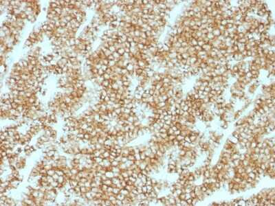 Immunohistochemistry-Paraffin: PTH Antibody (PTH/1717R) [NBP2-54474] - Formalin-fixed, paraffin-embedded human Parathyroid stained with PTH Recombinant Rabbit Monoclonal Antibody (PTH/1717R).