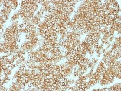 Immunohistochemistry-Paraffin: PTH Antibody (PTH/1717R) - N-terminal [NBP2-53170] - Formalin-fixed, paraffin-embedded human Parathyroid stained with PTH Recombinant Rabbit Monoclonal Antibody (PTH/1717R).