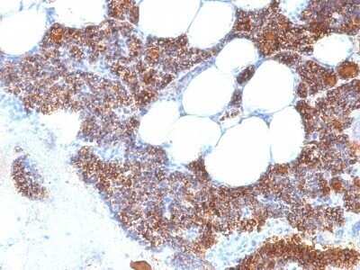 Immunohistochemistry-Paraffin: PTH Antibody (SPM604) - IHC-Prediluted [NBP2-48386] - Human Parathyroid stained with PTH Monoclonal Antibody (SPM604).