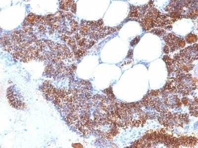 Immunohistochemistry-Paraffin: PTH Antibody (SPM604) - N-terminal [NBP2-45112] - Human Parathyroid stained with PTH Monoclonal Antibody (SPM604).