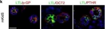 Immunocytochemistry/Immunofluorescence: PTH1R/PTHR1 Antibody (4D2) [NBP1-51640] - Generation of functional kidney spheroids using immortalized mouse primary cells. Representative images of mKidS immunostained for p-GP, OCT2, and PTHR. All data are shown as the means?+-?s.e.m. *p?less than ?0.05 compared with 2D or 3D control by unpaired Student's t-test. Scale bar, 20 um. Image collected and cropped by CiteAb from the following publication (//www.nature.com/articles/s41598-019-53855-2) licensed under a CC-BY license.