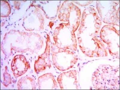 Immunohistochemistry-Paraffin: PTH1R/PTHR1 Antibody (4D2) [NBP1-51640] - Analysis of human kidney tissues using PTH1R mouse mAb with DAB staining.