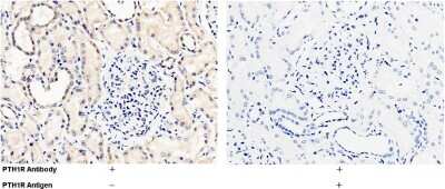 Immunohistochemistry-Paraffin: PTH1R/PTHR1 Antibody [NBP2-99962] - Immunochemical staining of human PTH1R/PTHR1 in human kidney with rabbit polyclonal antibody (1:1000, formalin-fixed paraffin embedded sections). Positive staining was localized to nephric tubule. The left panel: tissue incubated with primary antibody; Th