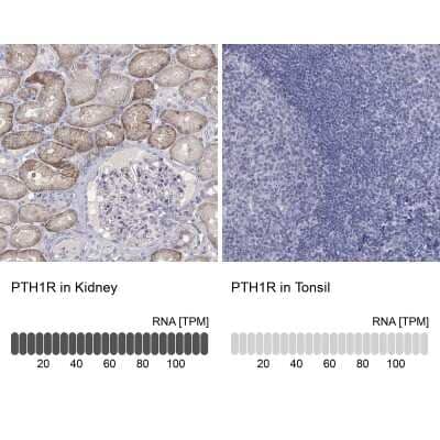 Immunohistochemistry-Paraffin: PTH1R/PTHR1 Antibody [NBP3-16996] - Analysis in human kidney and tonsil tissues using Anti-PTH1R antibody. Corresponding PTH1R RNA-seq data are presented for the same tissues.