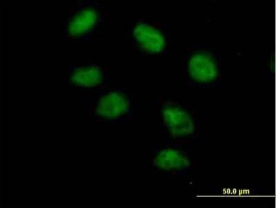 Immunocytochemistry/Immunofluorescence: PTIP Antibody [H00022976-B01P] - Analysis of purified antibody to PAXIP1 on HeLa cell. (antibody concentration 10 ug/ml)