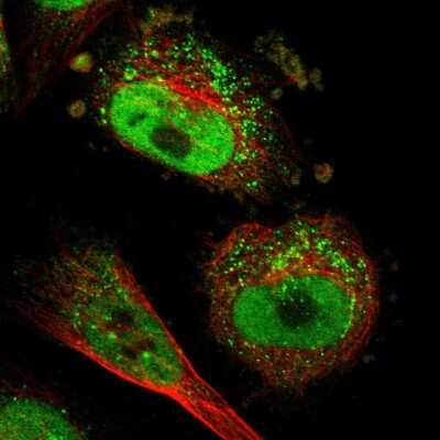 Immunocytochemistry/Immunofluorescence: PTIP Antibody [NBP2-33877] - Staining of human cell line U-251 MG shows positivity in vesicles & nucleus but excluded from the nucleoli. Antibody staining is shown in green. 