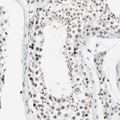 Immunohistochemistry-Paraffin PTIP Antibody