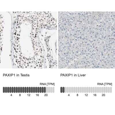 Immunohistochemistry-Paraffin PTIP Antibody