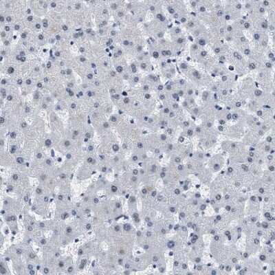 Immunohistochemistry-Paraffin: PTIP Antibody [NBP2-33877] - Staining of human liver shows low expression as expected.