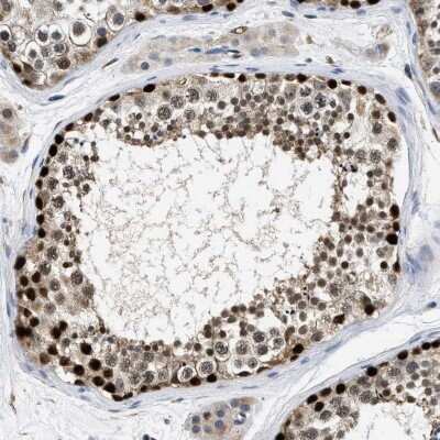 Immunohistochemistry-Paraffin: PTIP Antibody [NBP2-33877] - Staining of human testis shows high expression.