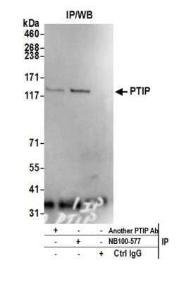 <b>Independent Antibodies Validation. </b>Immunoprecipitation: PTIP Antibody [NB100-577] - Detection of human PTIP by western blot of immunoprecipitates. Samples: Whole cell lysate (1.0 mg per IP reaction; 20% of IP loaded) from HEK293T cells prepared using NETN lysis buffer. Antibodies: Affinity purified rabbit anti-PTIP antibody NB100-577 used for IP at 3 ug per reaction. PTIP was also immunoprecipitated by rabbit anti-PTIP antibody from Company B. For blotting immunoprecipitated PTIP, NB100-577 was used at 1 ug/ml. Detection: Chemiluminescence with an exposure time of 3 minutes.