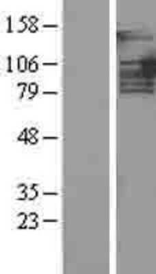 Western Blot PTIP Overexpression Lysate