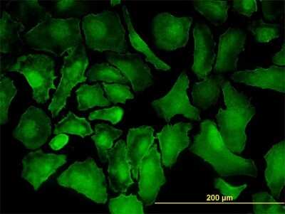 Immunocytochemistry/Immunofluorescence: PTK7/CCK4 Antibody (4F5) [H00005754-M06] - Analysis of monoclonal antibody to PTK7 on HeLa cell. Antibody concentration 10 ug/ml