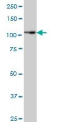 Western Blot PTK7/CCK4 Antibody (4F5)