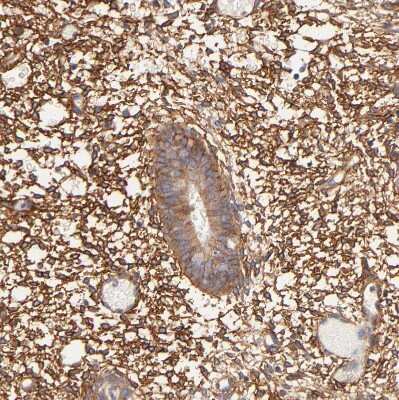 Immunohistochemistry-Paraffin: PTK7/CCK4 Antibody [NBP1-88157] - Staining of human endometrium shows strong membranous positivity in stromal cells.