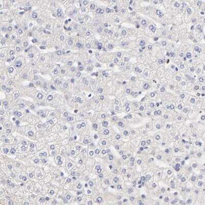 Immunohistochemistry-Paraffin: PTK7/CCK4 Antibody [NBP1-88157] - Staining of human liver shows no positivity in hepatocytes as expected.