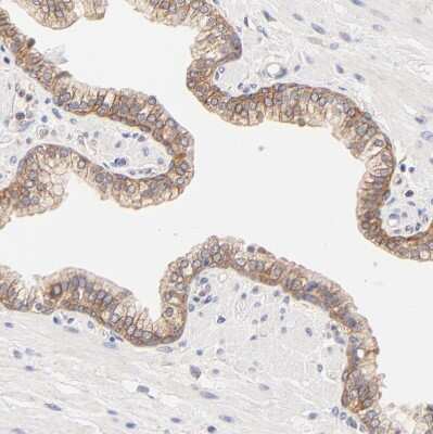 Immunohistochemistry-Paraffin: PTK7/CCK4 Antibody [NBP1-88157] - Staining of human prostate shows moderate membranous positivity in glandular cells.