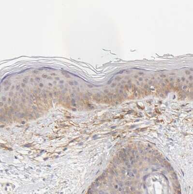 <b>Orthogonal Strategies Validation. </b>Immunohistochemistry-Paraffin: PTK7/CCK4 Antibody [NBP1-88157] - Staining of human skin shows weak membranous positivity in squamous epithelial cells.