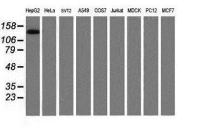 Western Blot: PTK7/CCK4 Antibody (OTI2E7) - Azide and BSA Free [NBP2-73708] - Analysis of extracts (35ug) from 9 different cell lines by using anti-CCK4 monoclonal antibody (HepG2: human; HeLa: human; SVT2: mouse; A549: human; COS7: monkey; Jurkat: human; MDCK: canine; PC12: rat; MCF7: human).