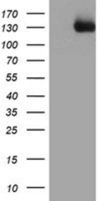 Western Blot: PTK7/CCK4 Antibody (OTI2E7) - Azide and BSA Free [NBP2-73708] - HEK293T cells were transfected with the pCMV6-ENTRY control (Left lane) or pCMV6-ENTRY CCK4 (Right lane) cDNA for 48 hrs and lysed. Equivalent amounts of cell lysates (5 ug per lane) were separated by SDS-PAGE and immunoblotted with anti-CCK4.
