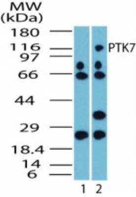 Western Blot: PTK7/CCK4 Antibody [NBP2-23655] - Analysis of PTK7 in HCT116 cell lysate. Lane 1 shows pre-immune sera. Lane 2 shows this antibody tested at 1:2500 dilution.