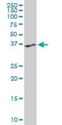 Western Blot: PTK9 Antibody (5C4) [H00005756-M06] - Analysis of PTK9 expression in PC-12 (Cat # L012V1).