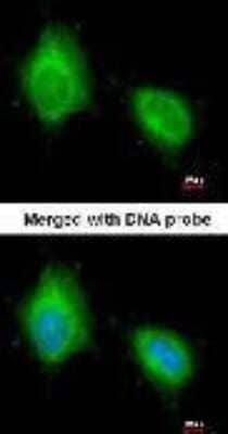 Immunocytochemistry/Immunofluorescence: PTK9 Antibody [NBP1-33132] - Analysis of paraformaldehyde-fixed A431