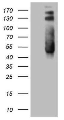 Western Blot: PTK9 Antibody (OTI5C12) - Azide and BSA Free [NBP2-73710] - HEK293T cells were transfected with the pCMV6-ENTRY control (Left lane) or pCMV6-ENTRY TWF1 (Right lane) cDNA for 48 hrs and lysed. Equivalent amounts of cell lysates (5 ug per lane) were separated by SDS-PAGE and immunoblotted with anti-TWF1.