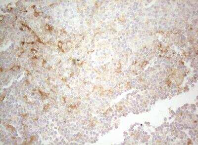 <b>Genetic Strategies Validation. </b>Immunohistochemistry-Paraffin: PTK9 Antibody (OTI5C12) [NBP2-46251] - Staining of paraffin-embedded Human lymph node tissue within the normal limits using anti-TWF1 mouse monoclonal antibody. 