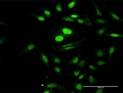 Immunocytochemistry/Immunofluorescence: PTMS Antibody [H00005763-D01P] - Analysis of antibody to PTMS on HeLa cell. Antibody concentration 30 ug/ml.