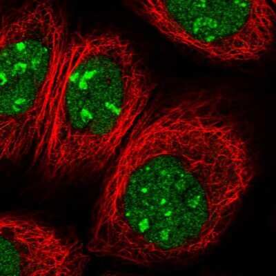 Immunocytochemistry/Immunofluorescence: PTMS Antibody [NBP1-80948] - Staining of human cell line A-431 shows localization to nucleus & nucleoli. Antibody staining is shown in green.
