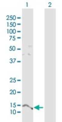 Western Blot: PTMS Antibody [H00005763-D01P] - Analysis of PTMS expression in transfected 293T cell line by PTMS polyclonal antibody.Lane 1: PTMS transfected lysate(11.50 KDa).Lane 2: Non-transfected lysate.