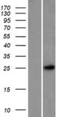 Western Blot: PTMS Overexpression Lysate (Adult Normal) [NBP2-08069] Left-Empty vector transfected control cell lysate (HEK293 cell lysate); Right -Over-expression Lysate for PTMS.