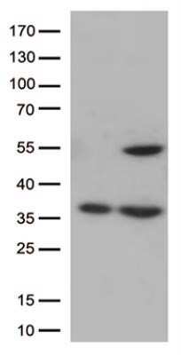 Western Blot: PTOP Antibody (OTI2D5) - Azide and BSA Free [NBP2-73711] - HEK293T cells were transfected with the pCMV6-ENTRY control (Left lane) or pCMV6-ENTRY CDK15(Right lane) cDNA for 48 hrs and lysed. Equivalent amounts of cell lysates (5 ug per lane) were separated by SDS-PAGE and immunoblotted with anti-CDK15.