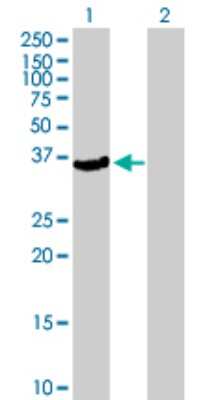 Western Blot: PTOP Antibody [H00065061-B01P] - Analysis of PFTK2 expression in transfected 293T cell line by PFTK2 polyclonal antibody.  Lane 1: ALS2CR7 transfected lysate(38.39 KDa). Lane 2: Non-transfected lysate.