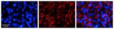 Immunohistochemistry: PTOV1 Antibody [NBP1-79384] - Formalin Fixed Paraffin Embedded Tissue: Human Pineal Tissue Observed Staining: Cytoplasmic and membrane in cell bodies and processes of pinealocytes and processes of intersticial cells Primary Antibody Concentration: 1:100 Other Working Concentrations: 1/600 Secondary Antibody: Donkey anti-Rabbit-Cy3 Secondary Antibody Concentration: 1:200 Magnification: 20X Exposure Time: 0.5 - 2.0 sec