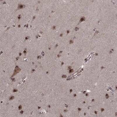 Immunohistochemistry PTOV1 Antibody - BSA Free