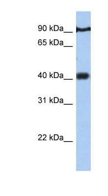 Western Blot: PTOV1 Antibody [NBP1-79384] - Jurkat cell lysate, concentration 0.2-1 ug/ml.