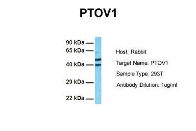 Western Blot PTOV1 Antibody - BSA Free