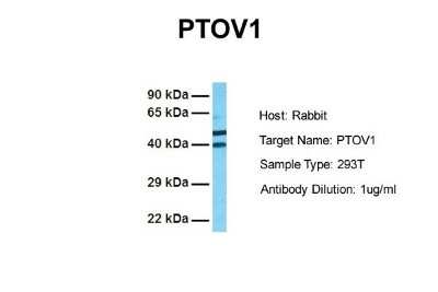 Western Blot: PTOV1 Antibody [NBP1-79384] - Sample Tissue: Human 293T Antibody Dilution: 1.0 ug/ml