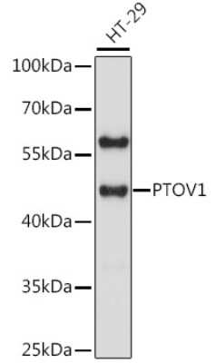 Western Blot: PTOV1 Antibody [NBP2-93875] - Analysis of extracts of HT-29 cells, using PTOV1 at 1:1000 dilution.Secondary antibody: HRP Goat Anti-Rabbit IgG (H+L) at 1:10000 dilution.Lysates/proteins: 25ug per lane.Blocking buffer: 3% nonfat dry milk in TBST.Detection: ECL Basic Kit .Exposure time: