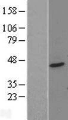 Western Blot: PTOV1 Overexpression Lysate (Adult Normal) [NBL1-14958] Left-Empty vector transfected control cell lysate (HEK293 cell lysate); Right -Over-expression Lysate for PTOV1.