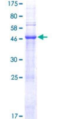 SDS-Page: PTOV1 Recombinant Protein [H00053635-P01]