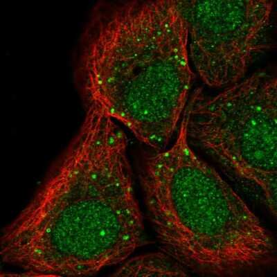 Immunocytochemistry/Immunofluorescence: PTP alpha/PTPRA Antibody [NBP2-57255] - Staining of human cell line HaCaT shows localization to nucleus & vesicles.