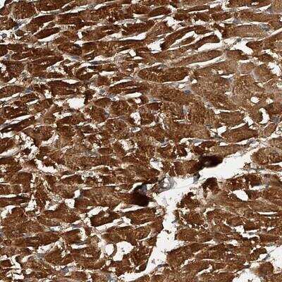 Immunohistochemistry: PTP alpha/PTPRA Antibody [NBP1-89683] - Staining of human heart muscle shows strong cytoplasmic positivity in myocytes.