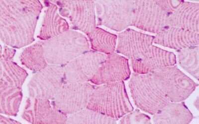 Immunohistochemistry-Paraffin: PTP alpha/PTPRA Antibody [NLS6792] - Anti-PTPRA antibody IHC of human skeletal muscle. Immunohistochemistry of formalin-fixed, paraffin-embedded tissue after heat-induced antigen retrieval. Antibody dilution 10 ug/ml.
