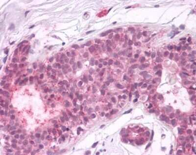 Immunohistochemistry-Paraffin: PTP alpha/PTPRA Antibody [NLS6794] - Analysis of anti-PTPRA antibody with human breast, epithelium at dilution 4 ug/ml.